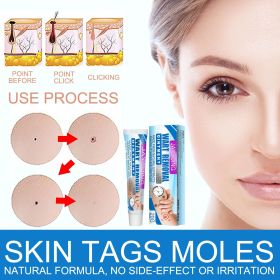 Jaysuing Warts Cream, Skin Granules Gram Wart Care Topical Cream